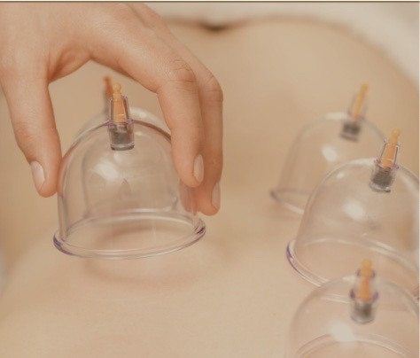 The Cupping Massage